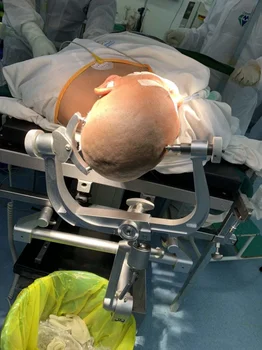 Medicale Cap De Craniu Repararea Neurochirurgie Dispozitive Chirurgicale - Imagine 2  
