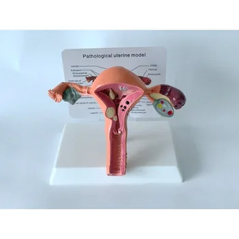 Reproducere Feminin Uterului Vaginale Ovar Anatomie Modelul De Predare Mucegai Boală Schimba Știința Didactice De Biologie - Imagine 1  